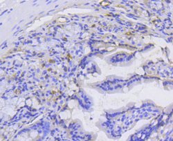 Invitrogen Catenin alpha-1 Recombinant Rabbit Monoclonal Antibody (SC0619)