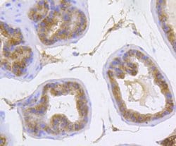Invitrogen Catenin alpha-1 Recombinant Rabbit Monoclonal Antibody (SC0619)