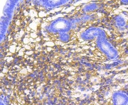 Invitrogen Catenin alpha-1 Recombinant Rabbit Monoclonal Antibody (SC0619)