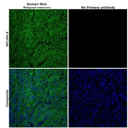 Invitrogen Melan-A Recombinant Rabbit Monoclonal Antibody (SC56-02) 100