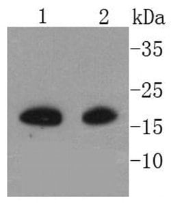 Invitrogen Melan-A Recombinant Rabbit Monoclonal Antibody (SC56-02) 100