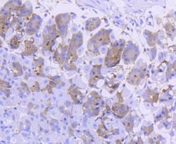 Invitrogen Asparagine Synthetase Recombinant Rabbit Monoclonal Antibody