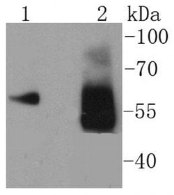 Invitrogen Asparagine Synthetase Recombinant Rabbit Monoclonal Antibody