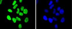 Invitrogen CHK2 Recombinant Rabbit Monoclonal Antibody (SC604) 100 &mu;L;