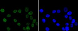 Invitrogen CHK2 Recombinant Rabbit Monoclonal Antibody (SC604) 100 &mu;L;