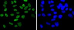 Invitrogen CHK2 Recombinant Rabbit Monoclonal Antibody (SC604) 100 &mu;L;