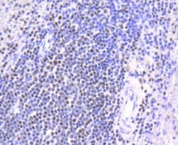 Invitrogen CHK2 Recombinant Rabbit Monoclonal Antibody (SC604) 100 &mu;L;