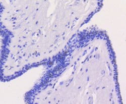 Invitrogen CHK2 Recombinant Rabbit Monoclonal Antibody (SC604) 100 &mu;L;