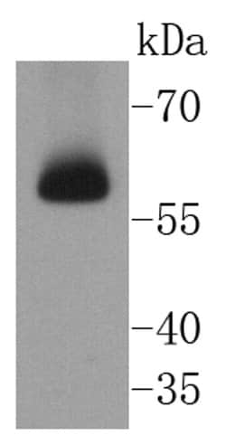 Invitrogen CHK2 Recombinant Rabbit Monoclonal Antibody (SC604) 100 &mu;L;