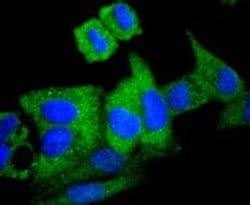 Invitrogen ATG7 Recombinant Rabbit Monoclonal Antibody (SC06-30) 100 &mu;L;