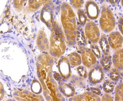 Invitrogen ATG7 Recombinant Rabbit Monoclonal Antibody (SC06-30) 100 &mu;L;