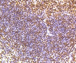 Invitrogen Phospho-SMC1 (Ser957) Recombinant Rabbit Monoclonal Antibody