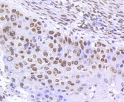Invitrogen Phospho-SMC1 (Ser957) Recombinant Rabbit Monoclonal Antibody