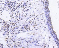 Invitrogen Phospho-SMC1 (Ser957) Recombinant Rabbit Monoclonal Antibody