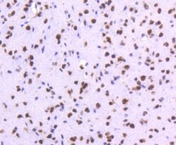 Invitrogen TOP1 Recombinant Rabbit Monoclonal Antibody (SC69-03) 100 &mu;L;