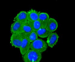 Invitrogen DKK1 Recombinant Rabbit Monoclonal Antibody (SC06-86) 100 &mu;L;