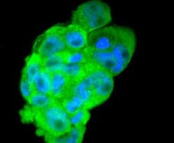Invitrogen DKK1 Recombinant Rabbit Monoclonal Antibody (SC06-86) 100 &mu;L;