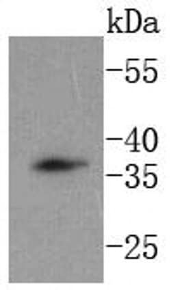Invitrogen DKK1 Recombinant Rabbit Monoclonal Antibody (SC06-86) 100 &mu;L;