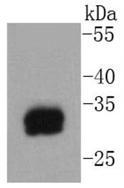 Invitrogen Tryptase Recombinant Rabbit Monoclonal Antibody (SC68-07) 100