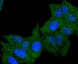 Invitrogen HLA-DR Recombinant Rabbit Monoclonal Antibody (SC06-78) 100