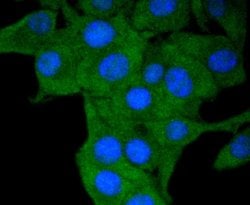 Invitrogen HLA-DR Recombinant Rabbit Monoclonal Antibody (SC06-78) 100