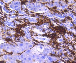 Invitrogen HLA-DR Recombinant Rabbit Monoclonal Antibody (SC06-78) 100