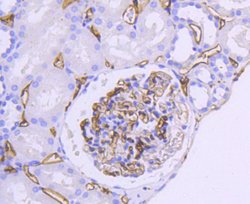 Invitrogen HLA-DR Recombinant Rabbit Monoclonal Antibody (SC06-78) 100