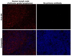 Invitrogen HLA-DR Recombinant Rabbit Monoclonal Antibody (SC06-78) 100