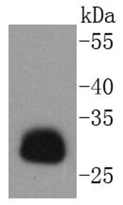Invitrogen HLA-DR Recombinant Rabbit Monoclonal Antibody (SC06-78) 100