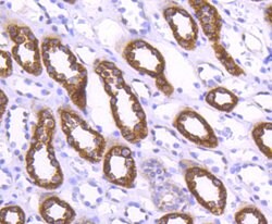 Invitrogen WAVE2 Recombinant Rabbit Monoclonal Antibody (SC66-05) 100 &mu;L;
