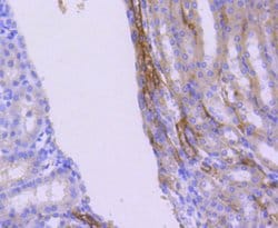 Invitrogen WAVE2 Recombinant Rabbit Monoclonal Antibody (SC66-05) 100 &mu;L;