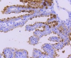 Invitrogen WAVE2 Recombinant Rabbit Monoclonal Antibody (SC66-05) 100 &mu;L;