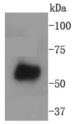 Invitrogen WAVE2 Recombinant Rabbit Monoclonal Antibody (SC66-05) 100 &mu;L;