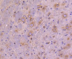 Invitrogen ATG9A Recombinant Rabbit Monoclonal Antibody (SC67-05) 100 &mu;L;