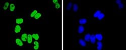 Invitrogen TCF7L2 Recombinant Rabbit Monoclonal Antibody (SC06-90) 100