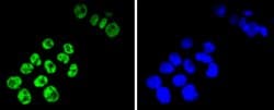 Invitrogen TCF7L2 Recombinant Rabbit Monoclonal Antibody (SC06-90) 100