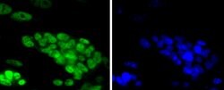 Invitrogen TCF7L2 Recombinant Rabbit Monoclonal Antibody (SC06-90) 100