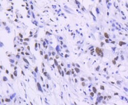 Invitrogen TCF7L2 Recombinant Rabbit Monoclonal Antibody (SC06-90) 100