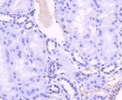 Invitrogen TCF7L2 Recombinant Rabbit Monoclonal Antibody (SC06-90) 100