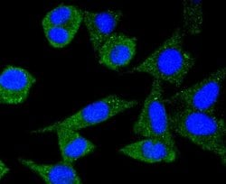 Invitrogen&trade;&nbsp;Ferritin Recombinant Rabbit Monoclonal Antibody (SC0620)