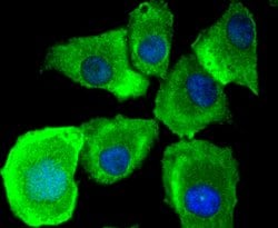 Invitrogen MyD88 Recombinant Rabbit Monoclonal Antibody (SC65-04) 100 &mu;L;
