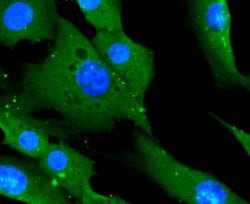 Invitrogen&trade;&nbsp;CD14 Recombinant Rabbit Monoclonal Antibody (SC69-02)
