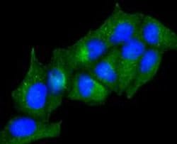 Invitrogen Adiponectin Receptor 1 Recombinant Rabbit Monoclonal Antibody