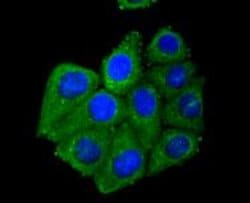 Invitrogen Adiponectin Receptor 1 Recombinant Rabbit Monoclonal Antibody