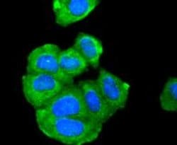 Invitrogen Adiponectin Receptor 1 Recombinant Rabbit Monoclonal Antibody