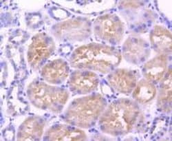 Invitrogen Adiponectin Receptor 1 Recombinant Rabbit Monoclonal Antibody