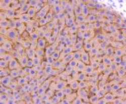 Invitrogen Adiponectin Receptor 1 Recombinant Rabbit Monoclonal Antibody