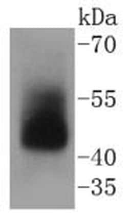 Invitrogen Adiponectin Receptor 1 Recombinant Rabbit Monoclonal Antibody