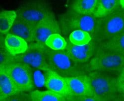 Invitrogen Cortactin Recombinant Rabbit Monoclonal Antibody (SC61-08) 100