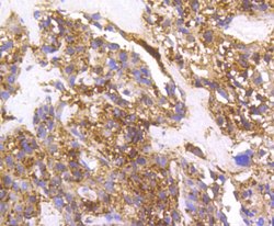 Invitrogen Cortactin Recombinant Rabbit Monoclonal Antibody (SC61-08) 100